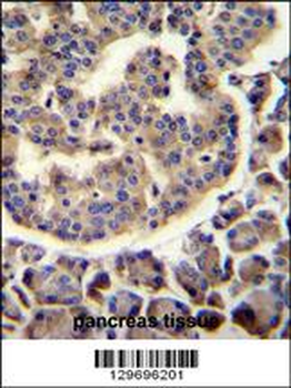 TRIM72 Antibody (C-term)