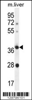OR4A15 Antibody (C-term)