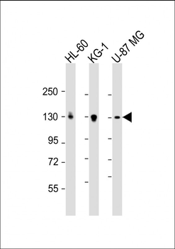 DEPDC5 Antibody (C-term)