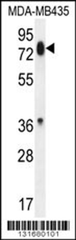 PCDHB13 Antibody (Center)