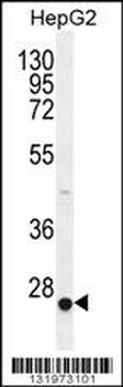 CACNG6 Antibody (Center)