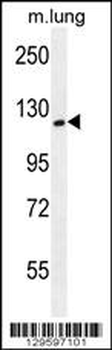 CYTSA Antibody (N-term)