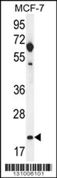 CLDN25 Antibody (Center)