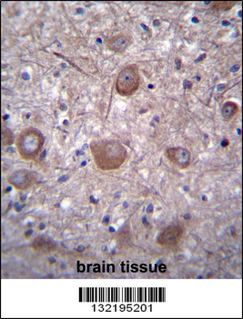 PPP3CC Antibody (N-term)
