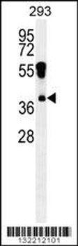 RHOXF2 Antibody (N-term)