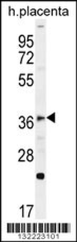 FOXI1 Antibody (Center)