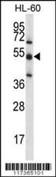 TOE1 Antibody (N-term)