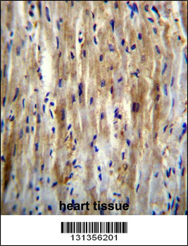SLC12A7 Antibody (N-term)