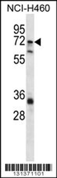 ST6GALNAC1 Antibody (N-term)