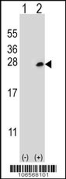 Dok5 Antibody (PTB domain)