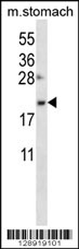 OSTC Antibody (C-term)