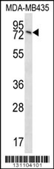 UNC84B Antibody (Center)