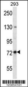 SPG7 Antibody (Center)