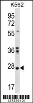 NKAIN1 Antibody (C-term)