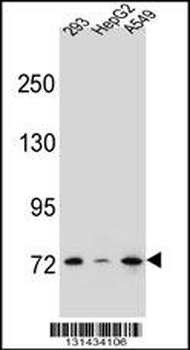 ZNF569 Antibody (N-term)