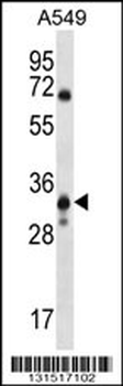 MCART6 Antibody (C-term)