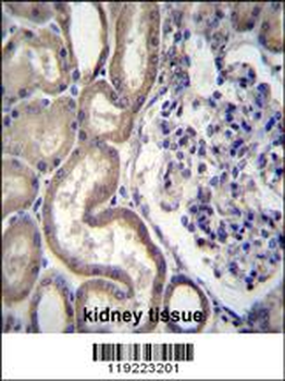 STIM2 Antibody (N-term)