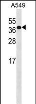 HOXD4 Antibody (C-term)