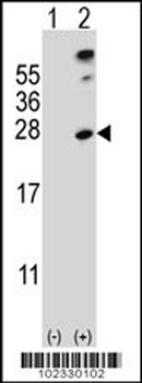 SENP8 Antibody (N-term)