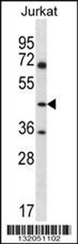 ASS1 Antibody (C-term)