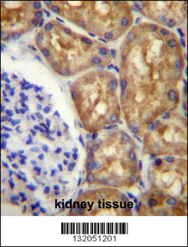 ASS1 Antibody (C-term)