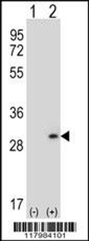 DPT Antibody (N-term)