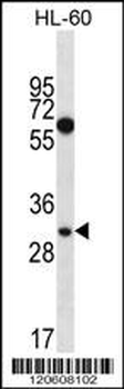 MED8 Antibody (Center)