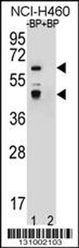PRAMEF3 Antibody (C-term)