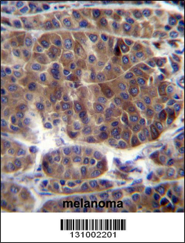 PRAMEF3 Antibody (C-term)