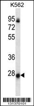 NRSN2 Antibody (C-term)