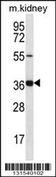 GRXCR1 Antibody (Center)