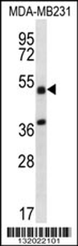 TRIM10 Antibody (C-term)