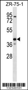 KCNK1 Antibody (C-term)