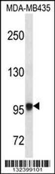 EXTL3 Antibody (N-term)
