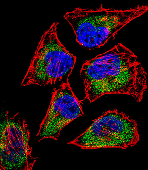 SIX5 Antibody (Center)