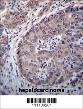 PNLIPRP3 Antibody (N-term)