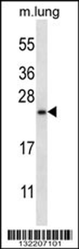RHEBL1 Antibody (N-term)