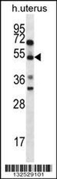 ABRA Antibody (C-term)
