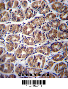 GPM6A Antibody (C-term)