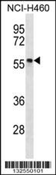 PHAX Antibody (C-term)