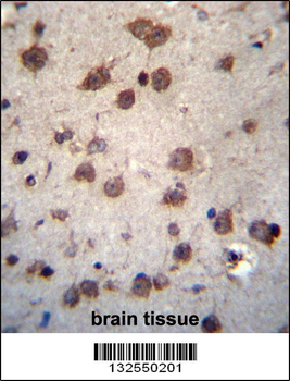 PHAX Antibody (C-term)