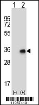 CNOT8 Antibody (N-term)