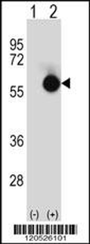 CTBP2 Antibody (N-term)
