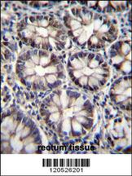 CTBP2 Antibody (N-term)