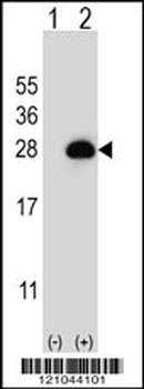 RAB3B Antibody (C-term)
