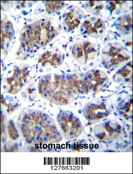TMM18 Antibody (Center)