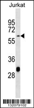MATN3 Antibody (Center)