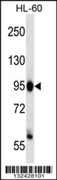 ZHX3 Antibody (C-term)