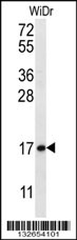 TBCA Antibody (N-term)