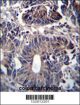 ZFYVE19 Antibody (C-term)